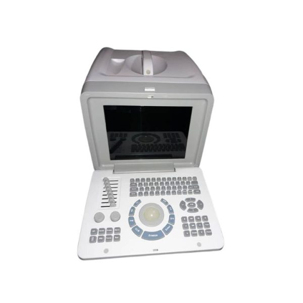 Oriel Plus portable ultrasound Machine - Digital Ultra Sounds