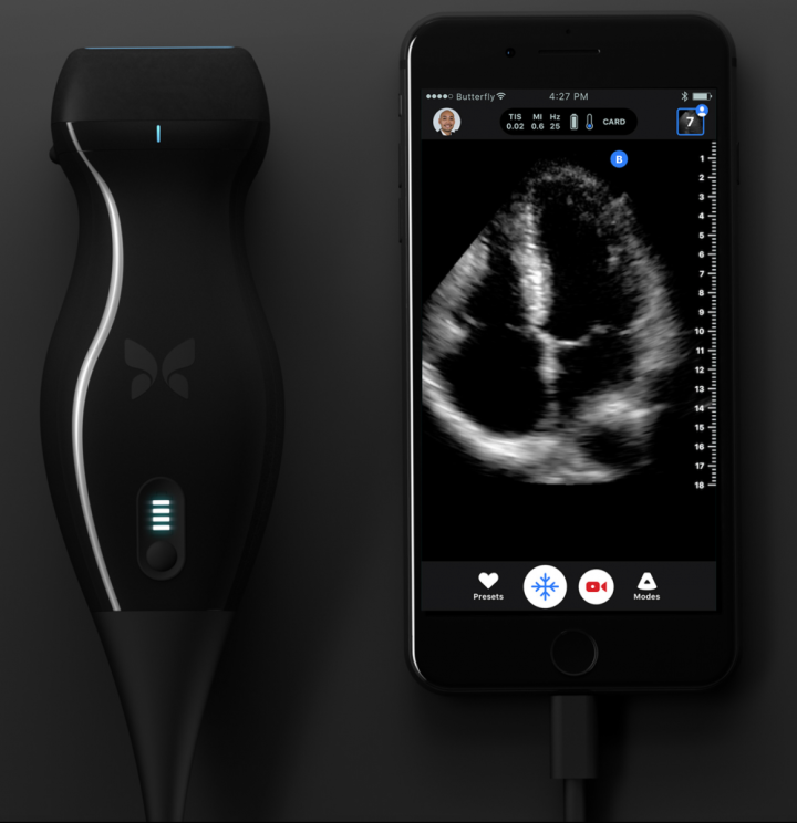 Butterfly iQ+ ultrasound